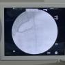 Angiografía coronaria derecha con lesion 