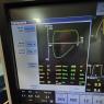 Ventilador mecánico configurado en el modo VCV